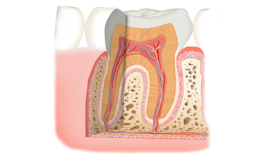 Zahnarzt Maintal, Zahnarztpraxis Maintal, Endodontie / Wurzelkanalbehandlung